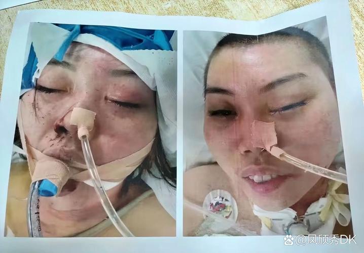 警方调查菲孕妇悲剧,